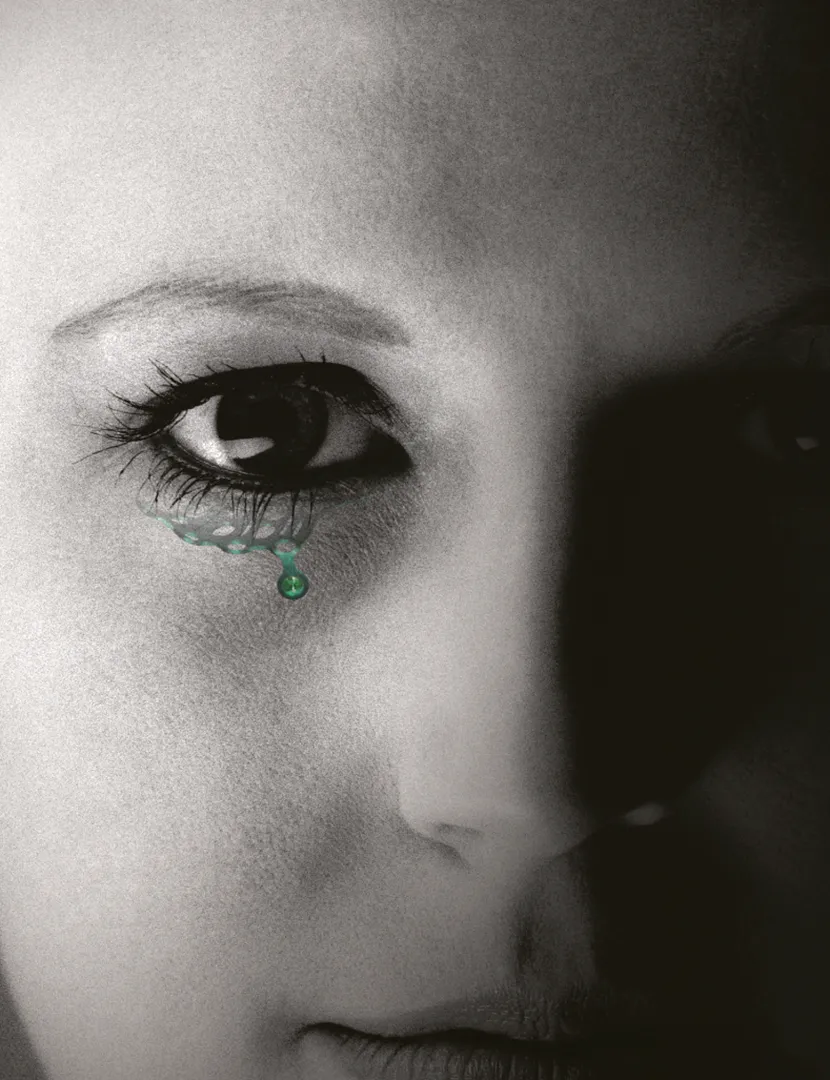 foto del mallas orbitarias marca zimmer biomet colocadas