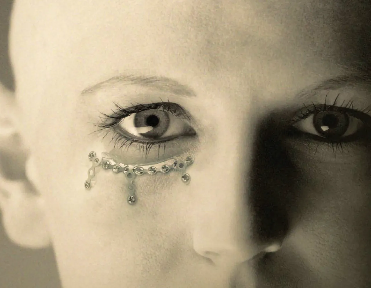 foto de sistema de placas lorenz midface de zimmer biomet