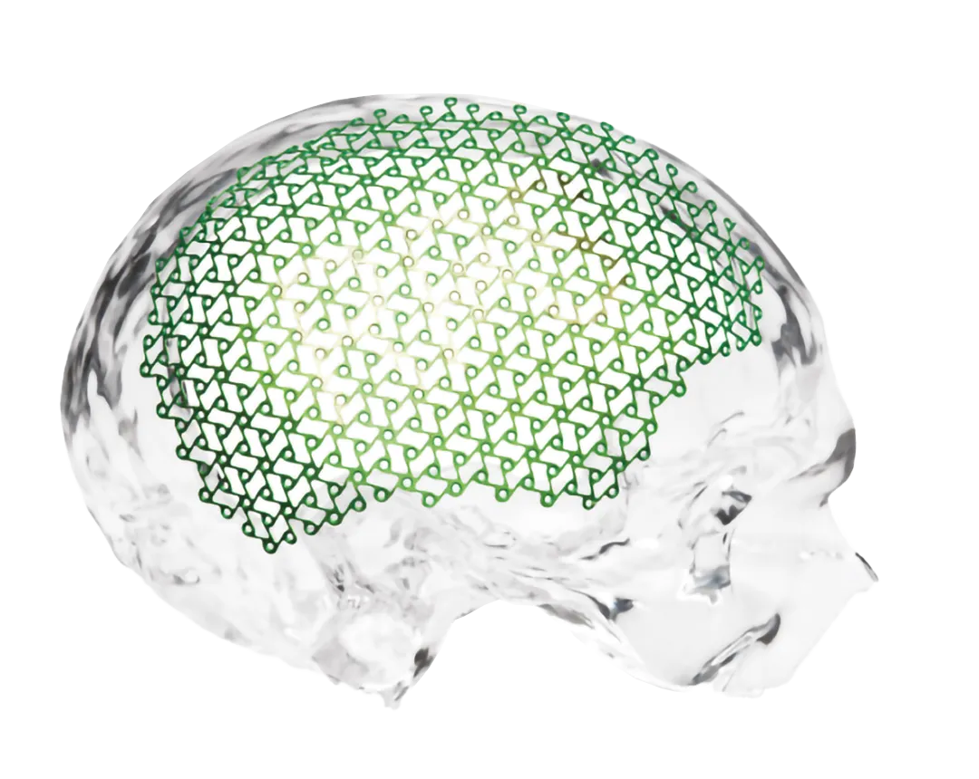 foto del sistema craniocurve para craeoplastia marca zimmer biomet