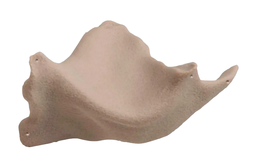 foto de implantes personalizados htr-pekk marca zimmer biomet