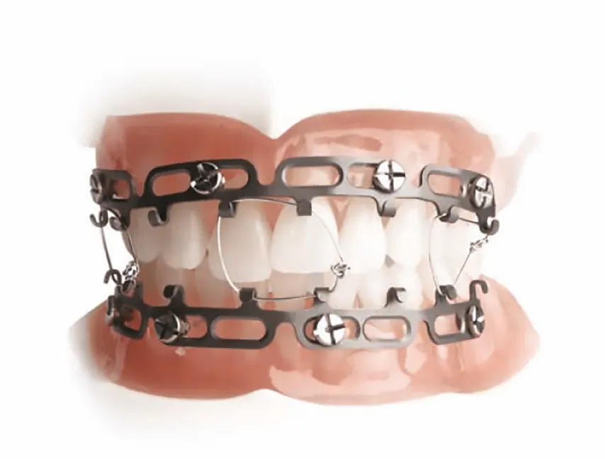 foto del sistema omnimax marca zimmer biomet colocado