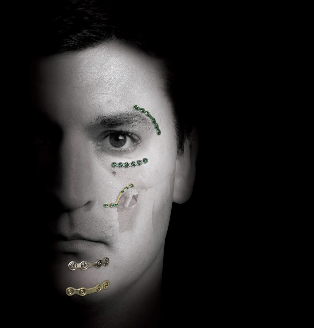 foto de sistema traumaone de zimmer biomet